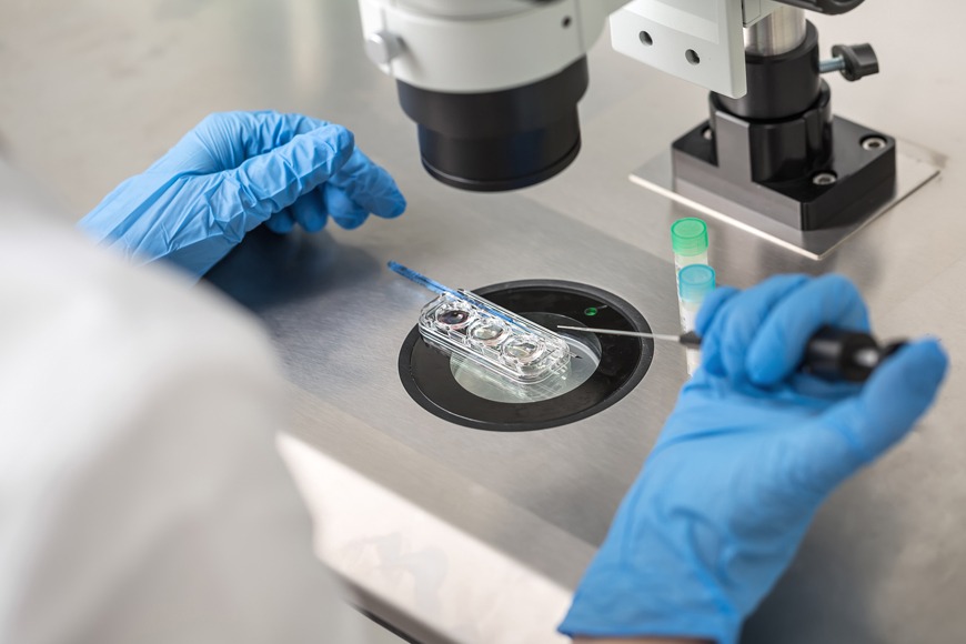 Sperm donation treatment in Dubai Sperm donation treatment in Dubai