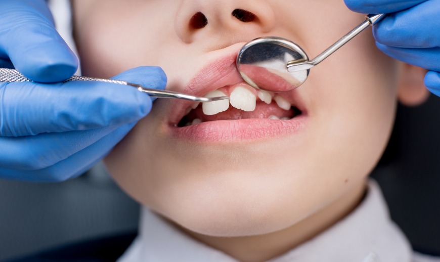 Kids Dental Health Kids Dental Health