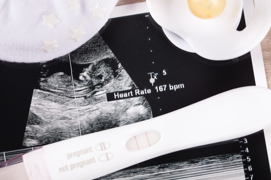 First Trimester of Pregnancy by EWmums First Trimester of Pregnancy by EWmums