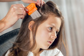Combat Head Lice in 4 Easy Steps