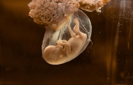 Embryo Freezing VS Egg Freezing