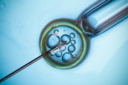 Do IVF Babies Face Greater Risk Of Premature Birth?